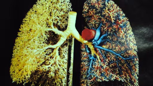 cancer-pulmonar.jpg