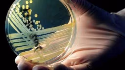 ecoli.jpg