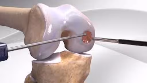 articulatii.jpg