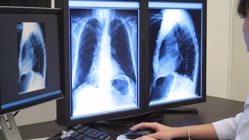 radiografieanaliza.jpg