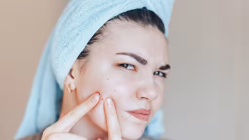 teenage-girl-squeezing-her-pimples-removing-pimple-her-face93267-412.jpg