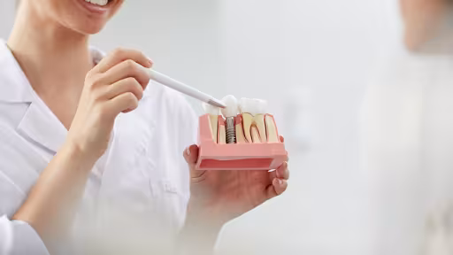 beneficii-implant-dentar.jpg