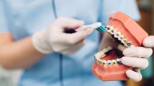 intretinere-aparat-dentar.jpg