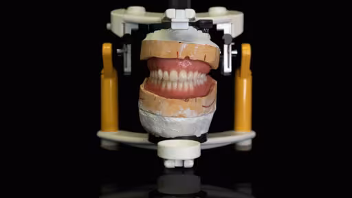 danturacompletaintr-osingurazi-tratamentulall-6lallldental.jpg